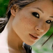 Nám và giải pháp đánh bay nám hiệu quả, an toàn 